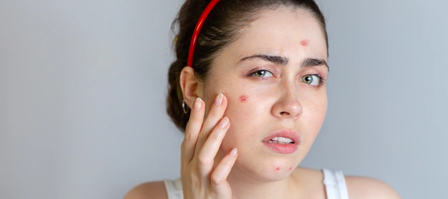 Best Homeopathic Treatment for Skin - Samarth homeopathy