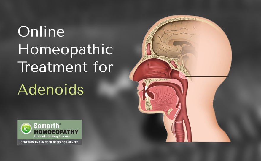 Online Homeopathic Treatment for Adenoids